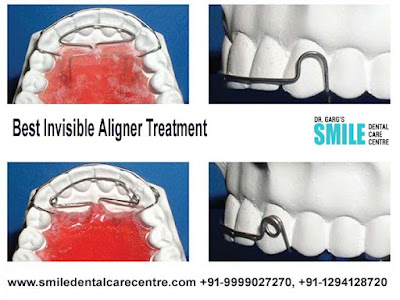 Dental Clinic Near Me Faridabad