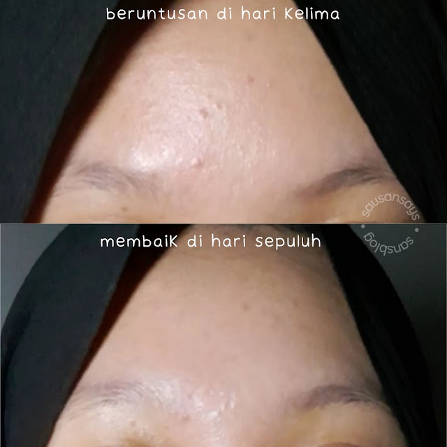 Hasil Pemakaian Basic Skincare Superfood Oil Serum Ocean Series