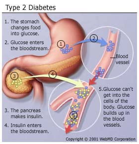 type 2 diabetes  effects