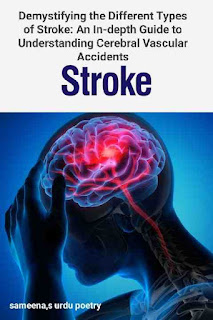 Demystifying the Different Types of Stroke: An In-depth Guide to Understanding Cerebral Vascular Accidents