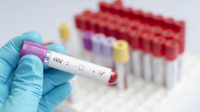 Waspada, Gejala-Gejala HIV Mirip Sakit Biasa