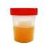 Possible Causes Of Cloudy Urine Everyone Should Know