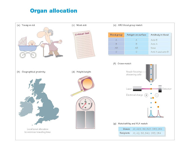 Organ Allocation, Eligibility for transplantation, Kidney transplantation, Pancreas transplantation, Liver transplantation, Heart transplantation, Lung transplantation, Principles in organ allocation, Allocation in practice, Kidney, Pancreas for islets or whole organ,