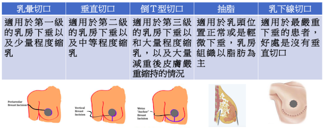 專長為：腹部抽脂整形、手臂抽脂整形、大腿抽脂整形、臉部拉提、上半身拉提手術、下半身拉提手術、乳房整形手術、隆乳手術、縮乳手術、提乳手術、乳頭整形、雙眼皮手術、下眼袋手術、開眼頭手術、開眼尾手術、鼻整形手術