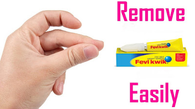 How to remove feviquick from skin