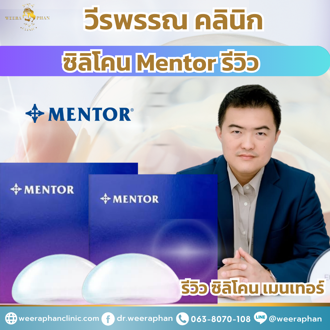 ซิลิโคน mentor รีวิว