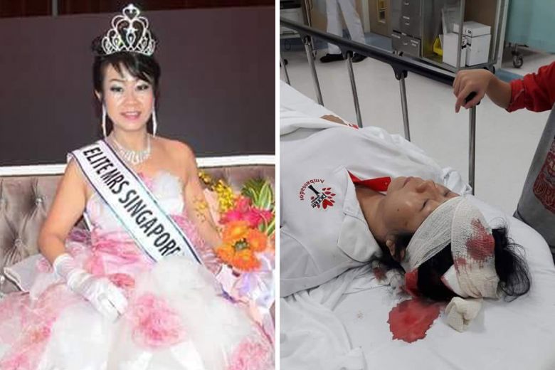 Former beauty queen injured in e-scooter accident at Bishan-Ang Mo Kio Park, posted on Thursday, 07 June 2018