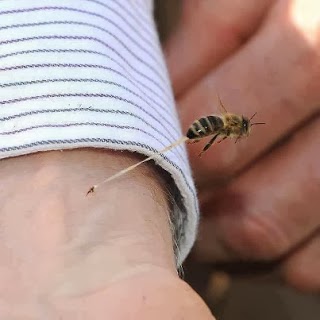 لمادا تموت النحلة بعد لسع الانسان ؟