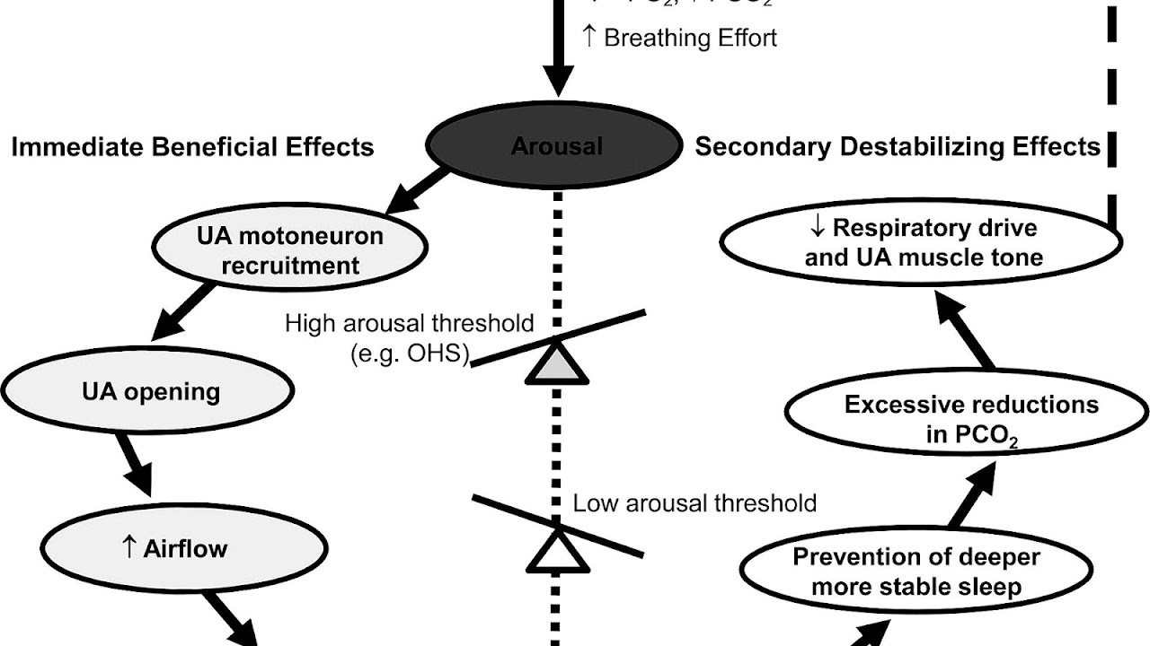 Obstructive sleep apnea