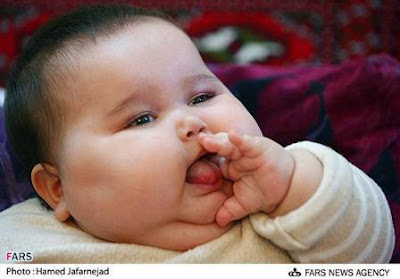 Unbeliveable 20 kg baby born in Tehran,Iran