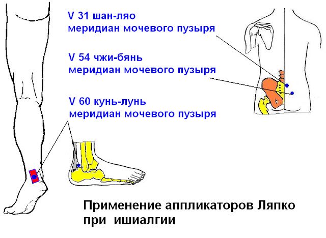 Почему болит голень при ходьбе. Чжи Бянь точка. Боль в стопе сбоку с внешней стороны. Боль в ступне сбоку с внутренней стороны.