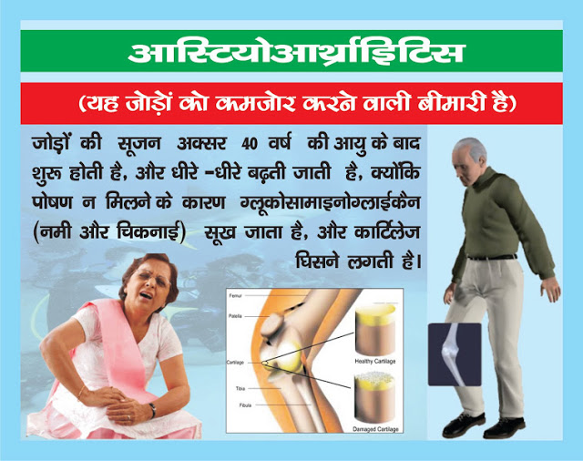 Vestige Glucosamine Tablets Benefits In Hindi Glucosamine