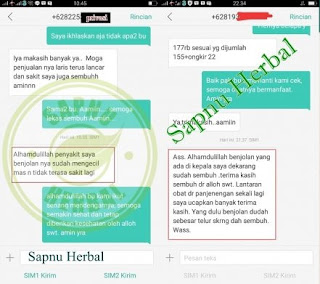 Cara Menghilangkan Benjolan Uci-Uci Tanpa Operasi