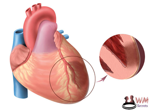 Myocardial Diseases (Myopathies, Myocarditis)