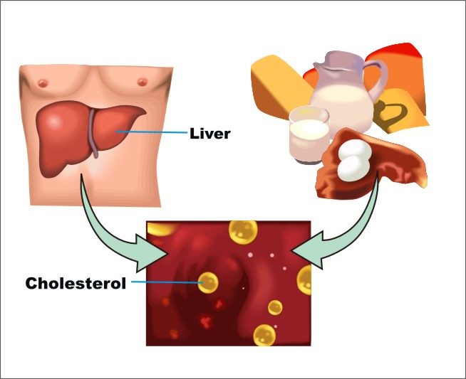 Kolesterol Jahat vs Kolesterol Baik - Ubat Pensil