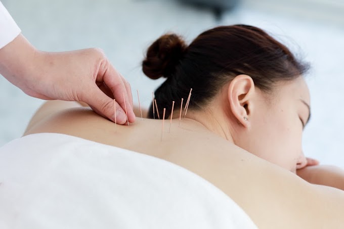Acupuncture as a Treatment