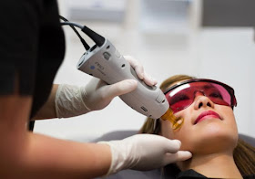 Using lasers for a tight and younger looking skin on Fashion and Cookies beauty blog, beauty blogger