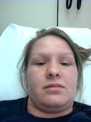 spider bite symptoms spider bite symptoms. spider bite symptoms