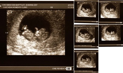 View Ultrasounds