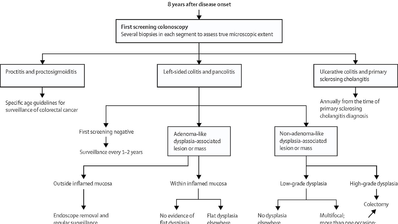Pathology Of Ulcerative Colitis