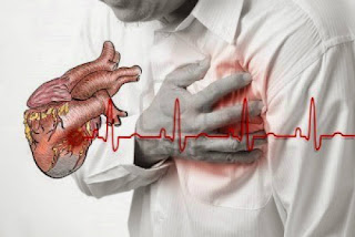 Ayo simak Ciri-ciri gejala penyakit jantung