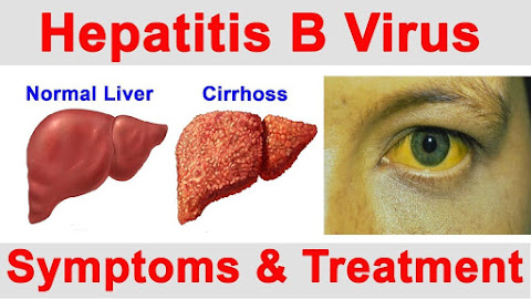 HEPATITIS B (LIVER) DETOX PACK