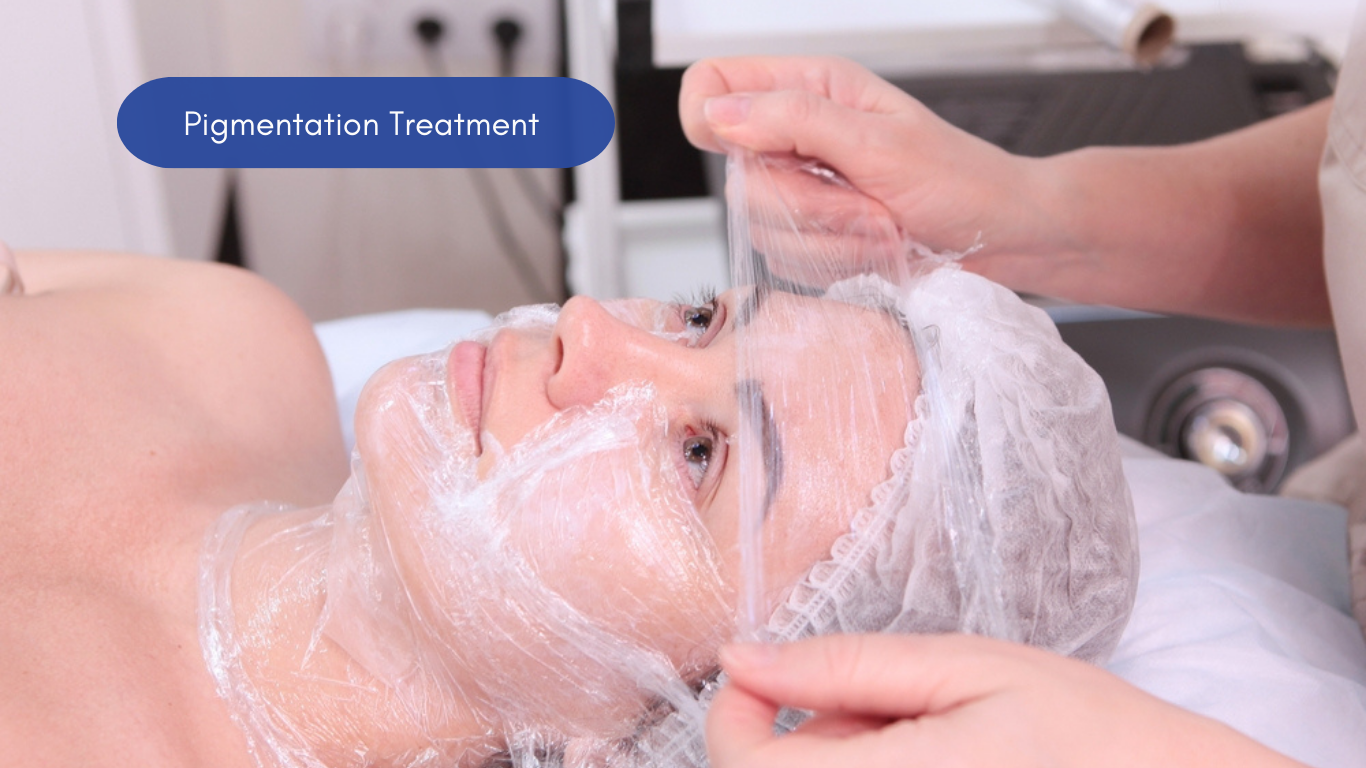 Skin Pigmentation Treatment in Coimbatore