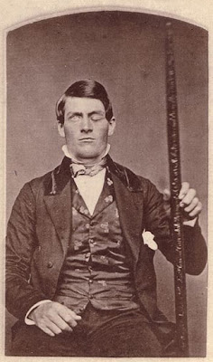 Phineas Gage