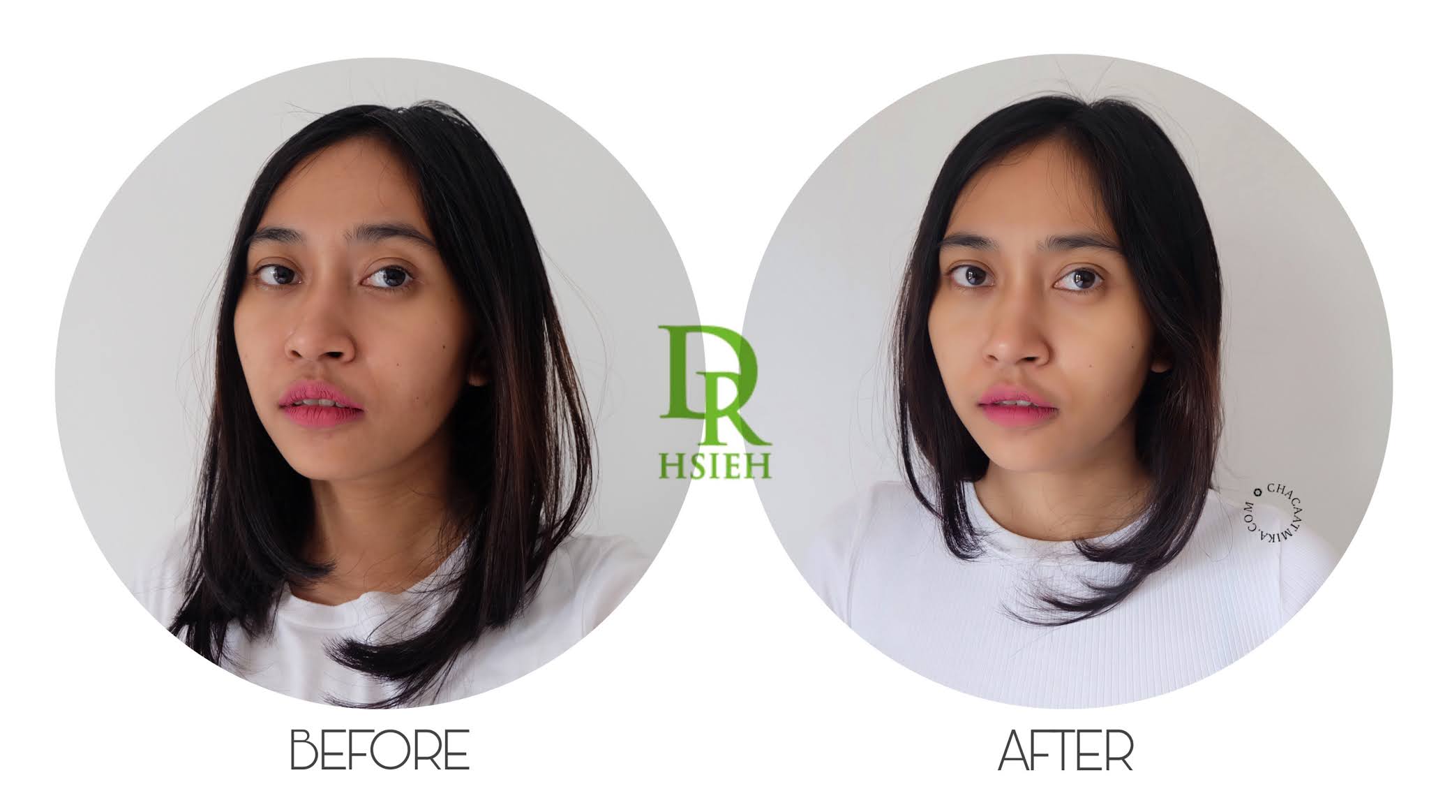 Before After Penggunaan Skin care Dr. Hsieh