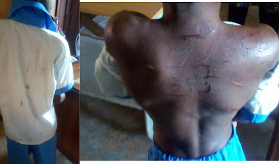 School Raises Alarm As Pupil Keeps Showing Up In Blood-Stained Uniform (Photos)