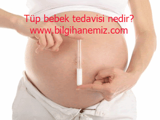 Tüp bebek tedavisi