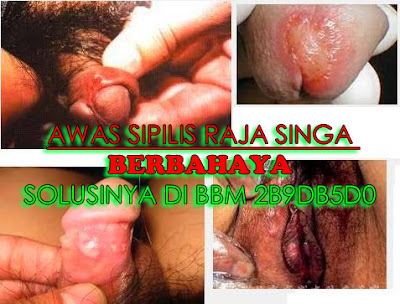 Obat Yang Digunakan Untuk Sipilis