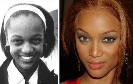 beyonce before and after nose. These efore and after