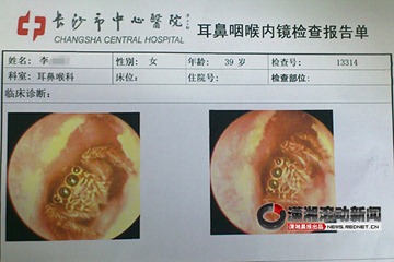 spider in ear