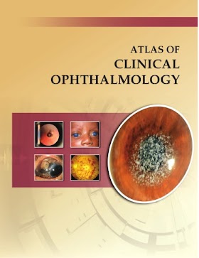 Atlas of Clinical Ophthalmology 2e