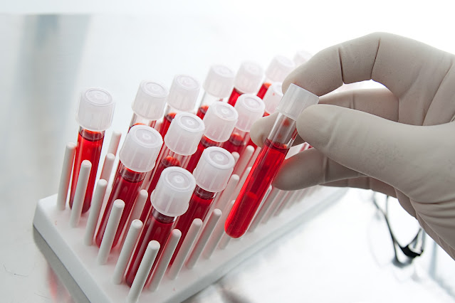 Blood Stream Infection Testing Market