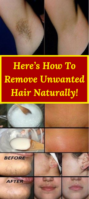 Here’s How To Remove Unwanted Hair Naturally!