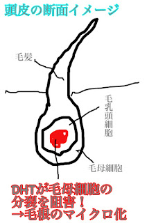 毛根の断面イメージ