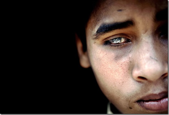 Salman, 13, a child presenting a severe neurological disorder and blindness, is portrayed in his home in the impoverished Arif Nagar colony, Bhopal, Madhya Pradesh, India, near the former Union Carbide (now DOW Chemicals) industrial complex.