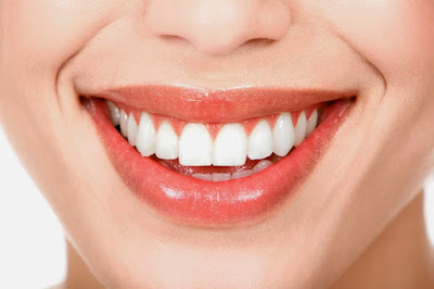 Cấy ghép răng implant ở đâu tốt nhất? 3