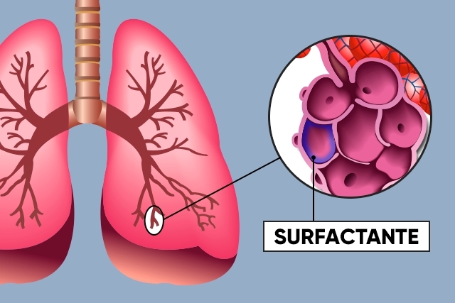 Pulmonary Surfactant Market