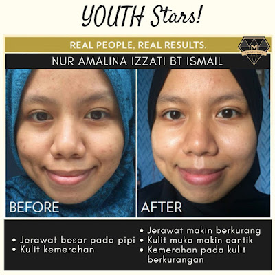 Testimoni Youth Star Shaklee