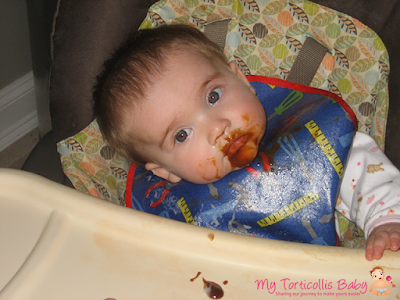 Baby with right torticollis sitting in her high chair