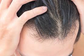 Is This Why Your Hair's Thinning? 