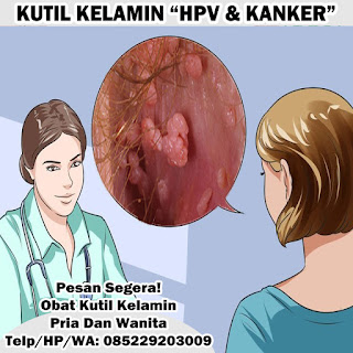 4 Obat Kutil Kelamin Kanker Jengger Ayam 3 Hari Langsung Coplok