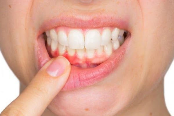 5 complications of dental avulsion that you should be aware of