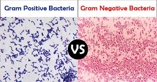 Perbedaan bakteri gram positif dan gram negatif di bawah mikroskop