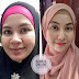  TIPS MERAWAT KULIT KUSAM