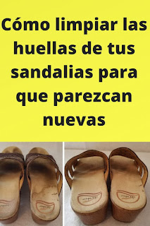 Cómo limpiar tus sandalias favoritas para que parezcan como nuevas