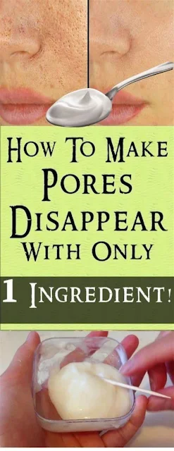 The Most Effective Method To Make Pores Disappear With Only 1 Ingredient – Naturally!
